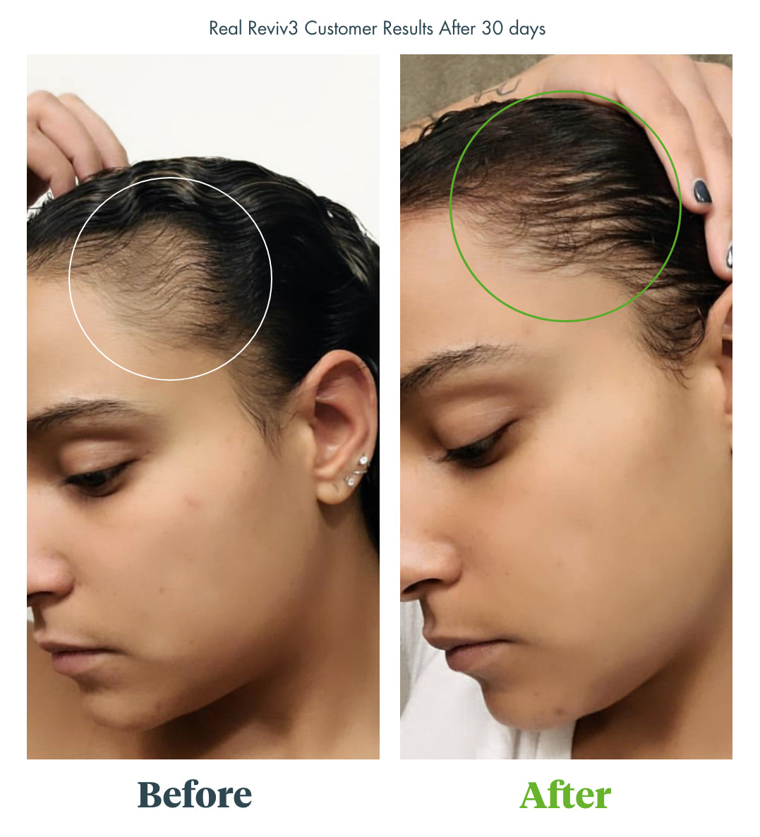before and after